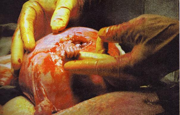 birth.jpg